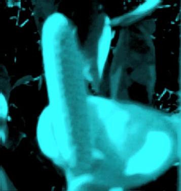 Pénis, arme de destruction massive de toutes sortes