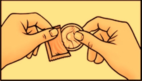 Prservatif masculin]